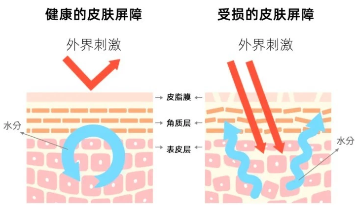 敏肌超爱的弥玥泉喷雾，喷一喷温和舒缓，轻松告别秋冬敏感